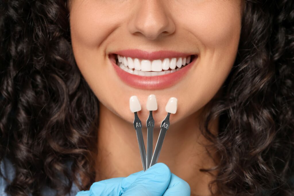 Nose-to-neck view of woman with dark curly hair smiling with veneers shade guide held to teeth